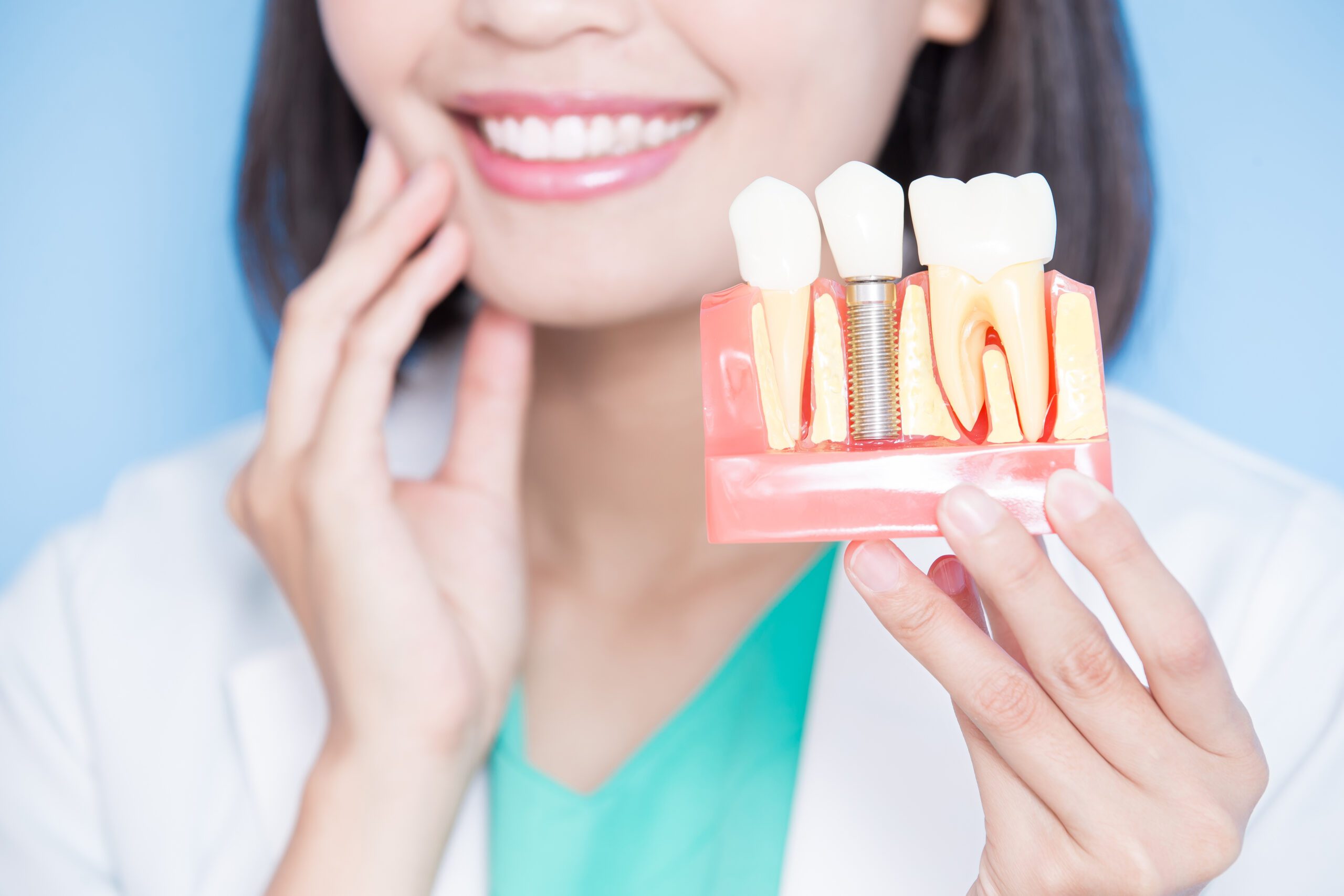 dental implants in St. Joseph