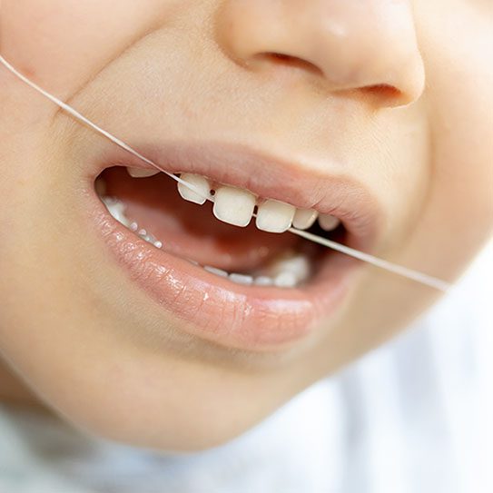 Jumpstart Your Child's Lifetime Flossing Habit -